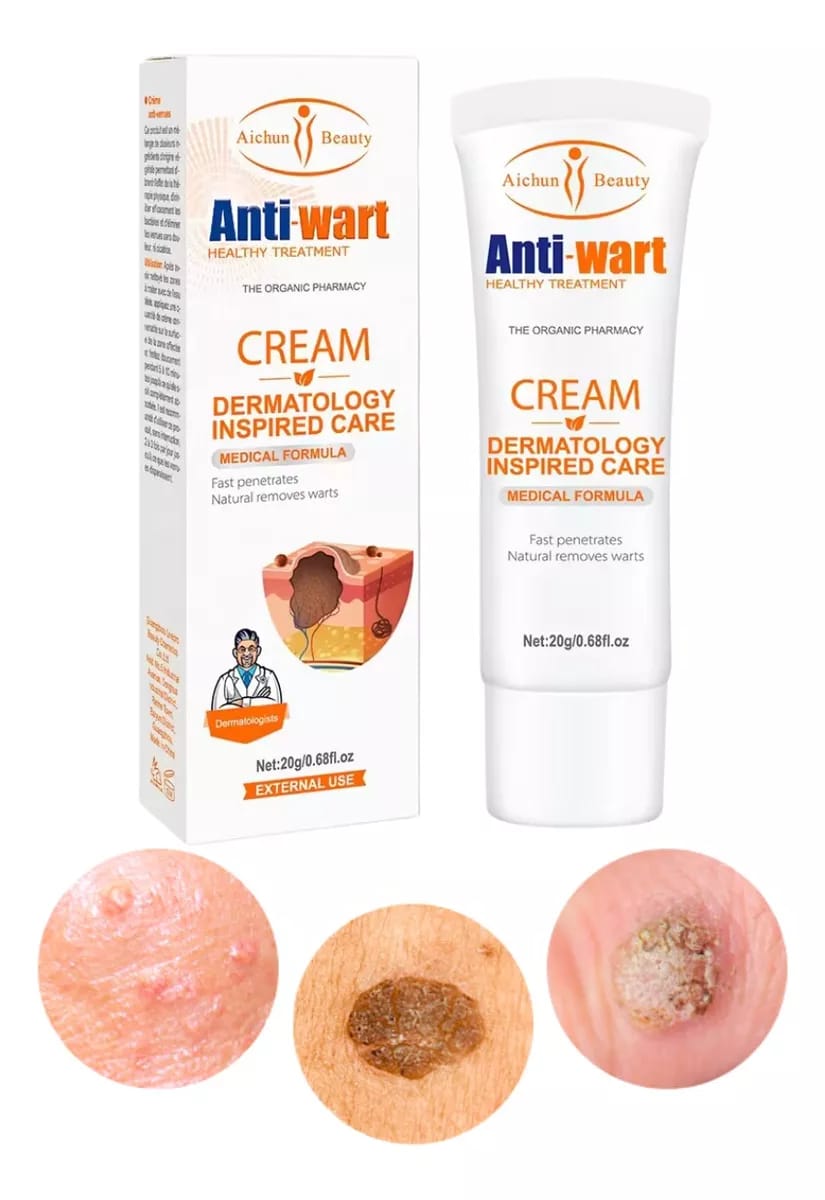 Crema dermatóloga para eliminar verrugas