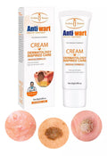 Crema dermatóloga para eliminar verrugas